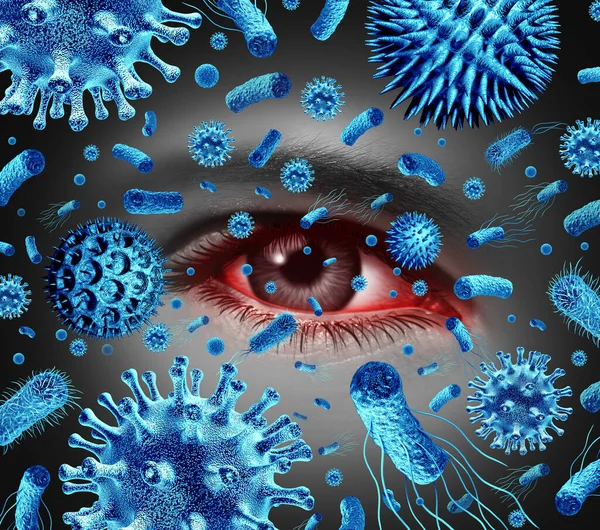 結膜炎目の感染症や感染症3Dイラスト要素と眼科や光のシンボルとして細菌やウイルス感染症やアレルギー反応やアレルギーとしてピンクの目 — ストック写真
