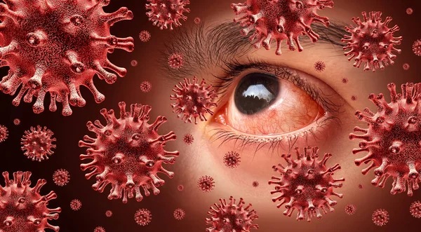 ウイルス性結膜炎感染性の高い眼感染症や感染性の高いピンク色の目をウイルス感染症やアレルギー反応として 眼科や3Dイラスト要素と光のシンボルとしてアレルギー — ストック写真