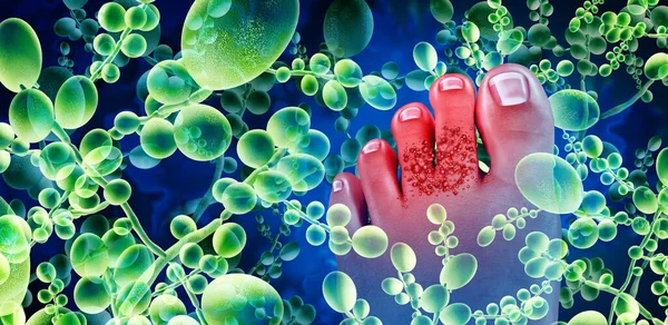 足の真菌感染症や足の真菌や皮膚科や3Dイラスト要素と医学的概念としての真菌の汚染 — ストック写真