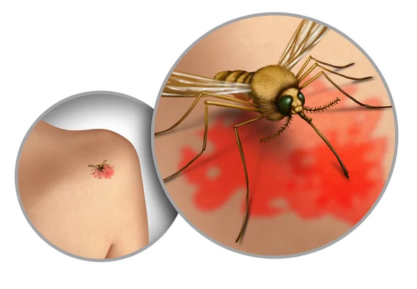 蚊子疾病的传播以及蚊子和蚊子在户外传播的危险 如疟疾和齐卡病毒等有害感染 作为预防疾病的一种昆虫标志 具有三维图例的野营风险 — 图库照片