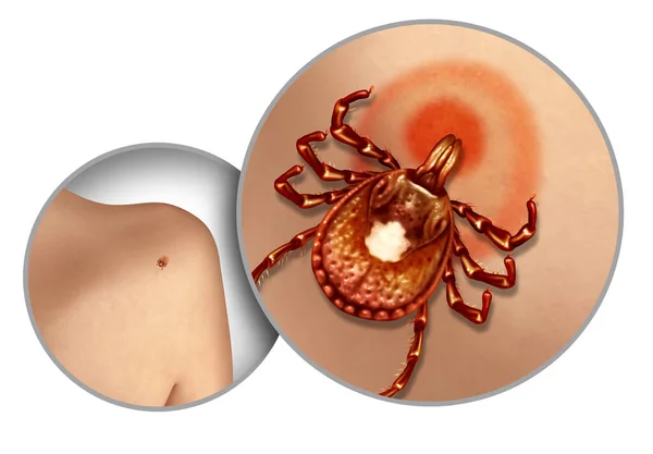 ローンスター3Dイラストスタイルで感染症の原因となる寄生虫の一口で健康上の危険性として感染症を広める病気や感染性ダニとして皮膚にティック — ストック写真