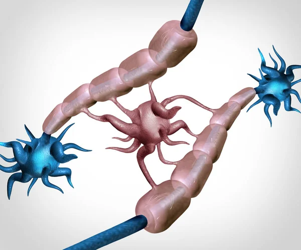Oligodendrocyte Células Mielinizantes Como Alzhiemers Esclerosis Múltiple Relacionados Autoinmune Neurodegeneración — Foto de Stock