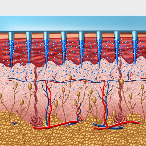 Microneedle or micro needle Medical device as a transdermal delivery medicine or drug delivered as small needle patch delivering medication under the skin as a 3D illustration.