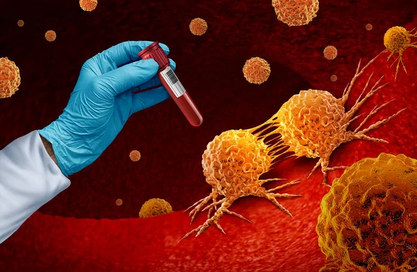 Cancer blood test and Multi malignant disease screening for early detection of cancers and cancerous tumor cells as genetics and immunotherapy or chemotherapy oncology symbol with 3D illustration elements.