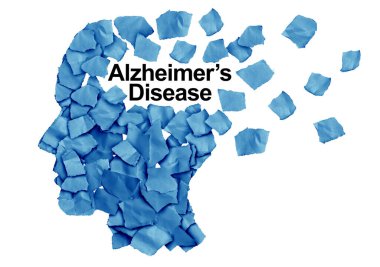 Alzheimer Disease as a cognitive decline as a degenerative dementia brain illness resulting in memory loss as a neurology symbol for aging of the mind. clipart