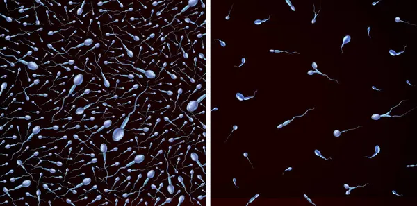 Количество Сперматозоидов Качество Мужское Бесплодие Проблемы Размножения Здоровые Аномальные Микроскопические Стоковая Картинка