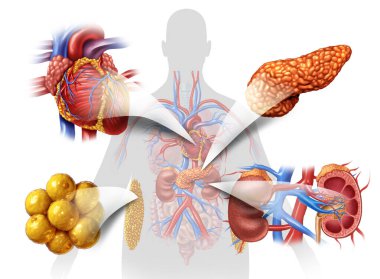 Cardiovascular kidney metabolic syndrome as a multisystem disorder as disease related to a group of organs as kidneys heart pancreas and Adipose cells. clipart