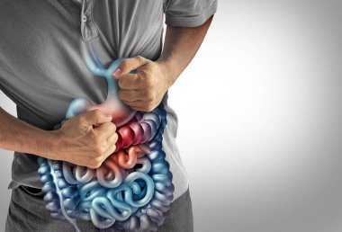 IBS Symptoms as irritable bowel syndrome or stomach ache and crohn's disease symbol and appendicitis cramps representing inflammation diarrhea and constipation as a person in intense gut pain. clipart