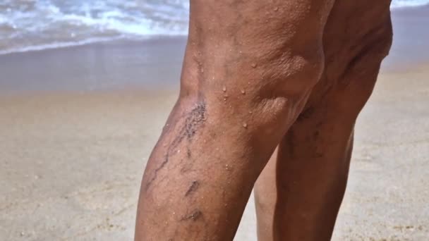 Starsza Kobieta Plaży Nogami Żylakami Zbliżenie Wysokiej Jakości Materiał Filmowy — Wideo stockowe