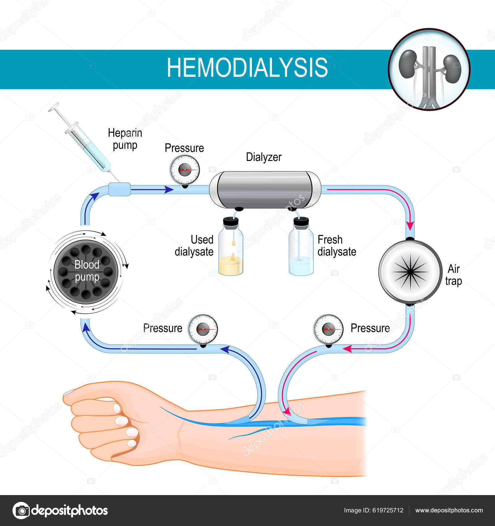 Principe Machine D'hémodialyse Processus Dialyse Hémodialyse Est ...