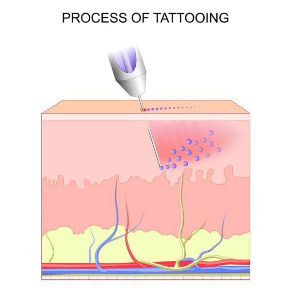 Tetoválás Emberi Bőr Rétegeinek Keresztmetszete Közelkép Tetoválás Folyamatáról Pigmentek Tetoválás — Stock Vector