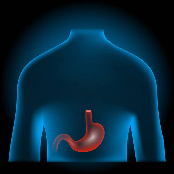 胃の痛み 消化管だ 消化器系だ X線青の現実的な胴に赤い胃 暗い背景に人間のシルエット 人体解剖学 ベクターポスター — ストックベクタ