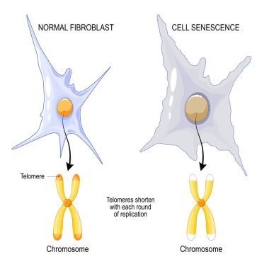 Normal fibroblast ve hücre yaşlanmasının kromozomu. Telomerler her replikasyon turunda daha da kısalırlar. Yaşlanma süreci. Vektör posteri