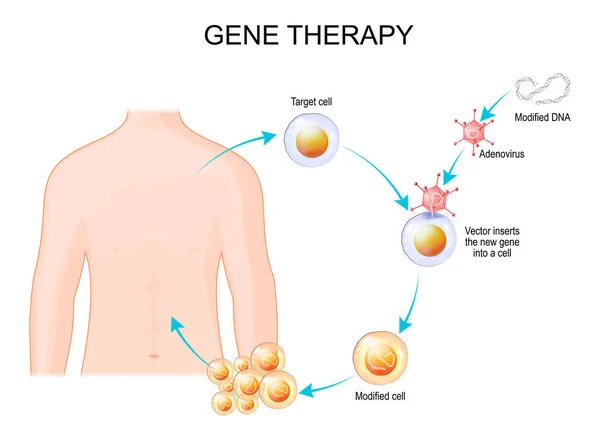 Genetikai Tervezés Adenovírus Vektorral Végzett Génterápia Vírus Beülteti Gént Egy — Stock Vector