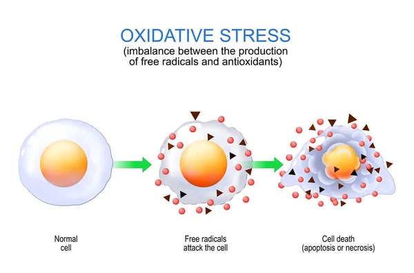 氧化性压 自由基生产和抗氧化剂生产之间的不平衡 从正常细胞到自由基攻击和细胞凋亡或坏死死亡 用于教育的病媒海报 — 图库矢量图片