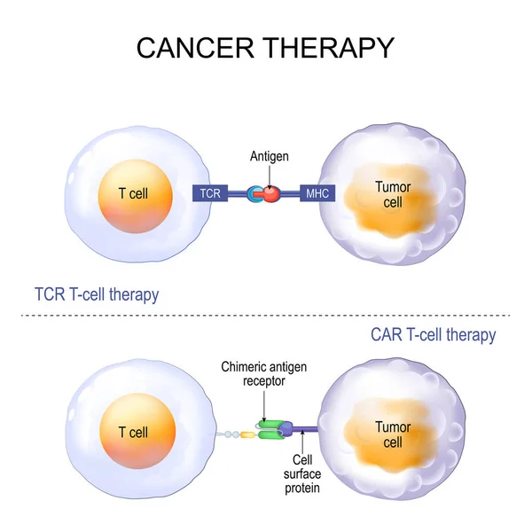 癌症治疗 用T细胞受体 Tcr 或衣壳抗原受体 Car 进行T细胞治疗 病媒宣传画 — 图库矢量图片