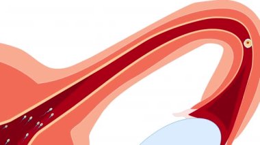 Yumurtlamadan implantasyona kadar. Bir insan embriyosunun gelişimi: yumurtlama, döllenme, birinci bölüm, morula ve rahim duvarına blastosist yerleştirme.