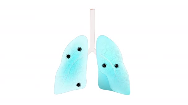 Human Lungs Viruses Pneumonia Acute Bronchitis — Stock Video