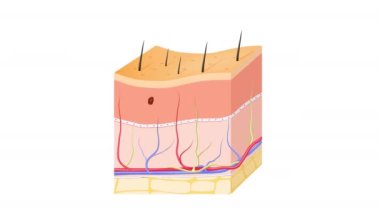 Cilt kanseri: Squamous cell carcinoma, bazal hücre kanseri (bazal hücrelerde başlar) ve Melanoma (pigment hücrelerinde, melanositlerde ortaya çıkar). İnsan derisi katmanları ve sağlıklı üst deri.