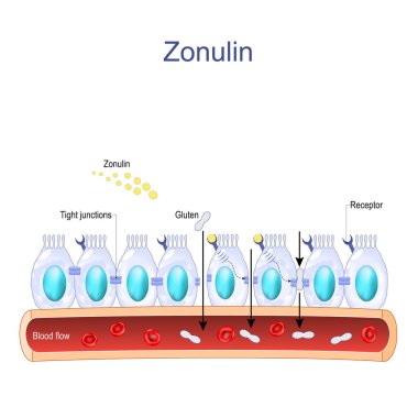 Zonulin is a protein that increases the permeability of tight junctions between cells of the wall of the gastrointestinal tract. digestive system. intestinal cells with Zonulin receptors, normal and Faulty tight junctions. Intestinal permeability. Gu clipart
