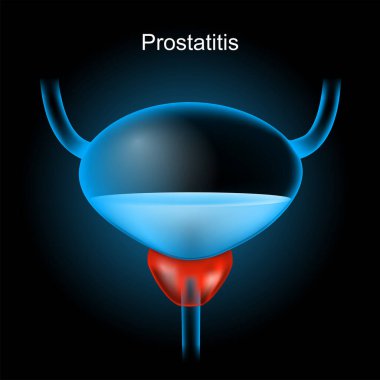 Fahişelik. Kırmızı prostat bezi ve koyu arka planda parlayan mavi gerçekçi mesane. İnsan idrar sistemi. Erkek üreme sisteminin bir parçası. X-ray resmi gibi vektör illüstrasyonu. 