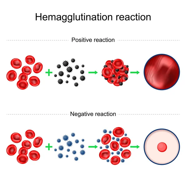 血凝反应 血型打字消极和积极的反应 凝集试验 实验室技术 用于通过观察凝块红血球的能力来确定抗体或抗原的存在 病媒宣传画 — 图库矢量图片