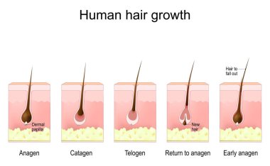 Human hair growth. life cycle of hair follicle. phases anagen, catagen, telogen, and Early anagen. Cross section of a human skin with hair follicle, and Dermal papilla. Vector illustration clipart
