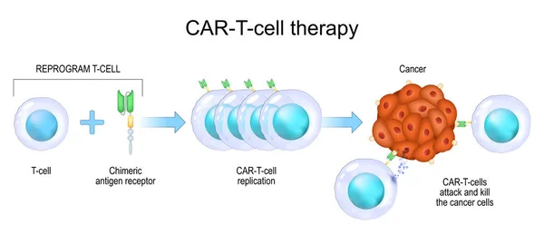 Araba Hücre Terapisi Kanser Bağışıklık Tedavisi Tümör Hücrelerinin Öldürülmesi Genetik — Stok Vektör