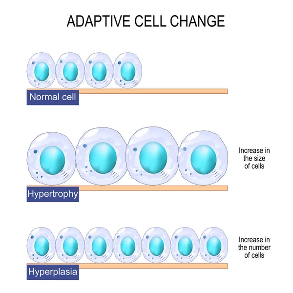 Adaptivní Změna Buňky Normální Buňky Hypertrofie Zvýšení Velikosti Buněk Hyperplazie — Stockový vektor