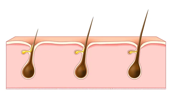 髪の成長 毛包を持つ人間の皮膚の断面 ベクターイラスト — ストックベクタ