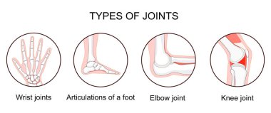 Eklem tipleri. Biyomekanik ve anatomik sınıflandırma. İnsan dirseği, diz, bilek eklemleri ve ayak eklemleriyle simgeler oluşturun. Kemikler ve eklemler. Klinik için tıbbi poster. vektör illüstrasyonu.