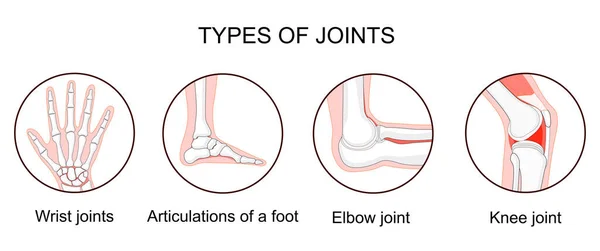 関節の種類 生体力学的および解剖学的分類 人間の肘 手首の関節 および足のアーティキュレーションでアイコンを設定します 骨と関節 診療所の医療ポスター ベクターイラスト — ストックベクタ