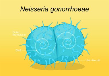 Neisseria gonorrhoeae patojen bakterisi. Cinsel yolla bulaşan hastalık ve gonokok enfeksiyonu. Genital bölge enfeksiyonu. Vektör posteri