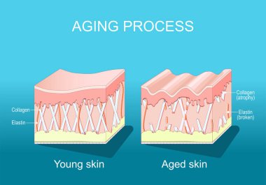 Yaşlanma süreci. Genç ve yaşlı cilt karşılaştırması. Kolajen, Elastin ve daha genç ve yaşlı ciltlerde fibroblastlar. Kolajen fiber atrofisi ve Elastin kırıldığında ciltte yaşla ilgili değişiklikler oldu. Isometric Düz vektör çizimi.