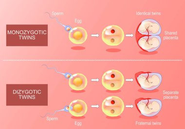 Zygote development in monozygotic and dizygotic twins. From Fertilization, egg plus sperm to amniotic sacs formation. Isometric Vector. Flat illustration clipart