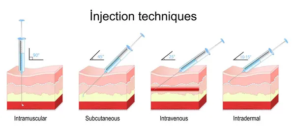 Injektionsmethoden Querschnitt Einer Menschlichen Haut Mit Spritze Nadeleinführungswinkel Für Intramuskuläre lizenzfreie Stockillustrationen