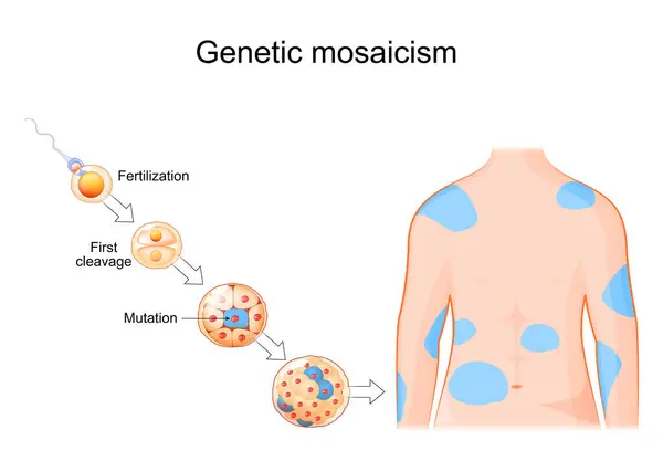 stock vector Genetic mosaicism. Somatic mutation. DNA replication errors. Cell development from Fertilization to morula with mutation. Human body with affected areas. Somatic genome editing. Vector illustration