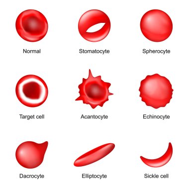 Shape of red blood cell. Sickle cell, Echinocyte, Spherocyte, Elliptocyte, Acantocyte, Stomatocyte, Dacrocyte, Target cell and Normal Erythrocyte. Poikilocytosis. Blood diseases. Vector illustration clipart