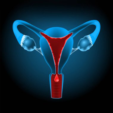 Uterine bleeding. Menstruation. Cut-away view of the uterus. female reproductive system. Vector illustration like X-ray image for healthcare design. Reproductive health. clipart