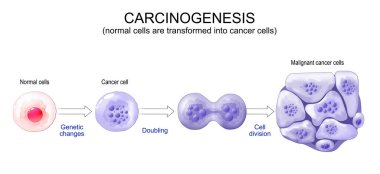 Cancer development. Normal cells are transformed into cancer. Carcinogenesis from Genetic mutations in healthy cell to Malignant cancer cells. Mutagenesis, Oncogenesis or tumorigenesis. Tumor formation. Vector illustration.  clipart