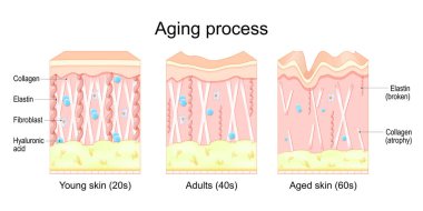Yaşlanma süreci. Gençlerin, yetişkinlerin ve yaşlanmış ciltlerin karşılaştırılması. Kolajen, Elastin, Hyaluronik asit ve daha genç ve yaşlı ciltlerde fibroblastlar. Kolajen fiber atrofisi ve Elastin kırıldığında ciltte yaşla ilgili değişiklikler oldu. Vektör illüstrasyonu