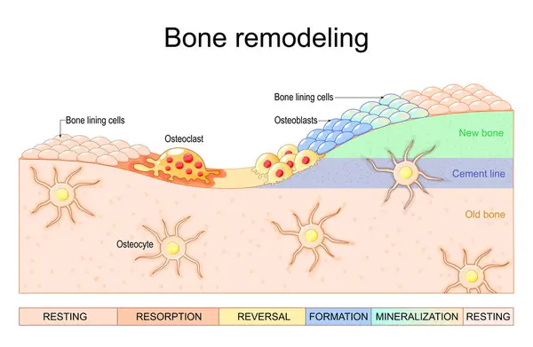 stock vector Bone remodeling process. Close-up of Osteoblasts, Osteoclast, Osteocytes and bone lining cells. Bone resorption and matrix formation. Vector illustration