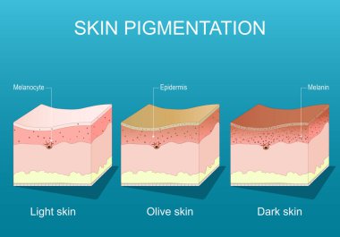 Skin pigmentation. Cross section of a human Epidermis with Melanocytes, and Melanin. Human skin color ranges. Light, Olive, and Dark skin on blue background. Detailed Vector poster. Isometric Flat  illustration. Schematic diagram clipart