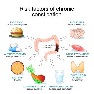 Kronik kabızlığın risk faktörleri. Gastrointestinal peristaliz ve kronik kabızlık. Bağırsak hareketlerinde düzensizlik var. Gut hareketlilik bozuklukları. Vektör illüstrasyonu