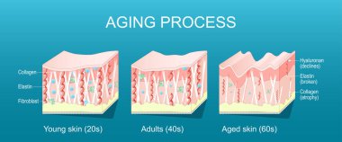 Yaşlanma süreci. Gençlerin, yetişkinlerin ve yaşlanmış ciltlerin karşılaştırılması. Kolajen, Elastin, Hyaluronik asit ve daha genç ve yaşlı ciltlerde fibroblastlar. Tıbbi şema. Vektör illüstrasyonu