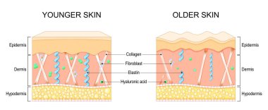 Yaşlanan deri yaraları. Kırışıklık oluşumu. Daha yaşlı ve daha genç cildin kesitleri. Elastin, Kolajen lifleri, Hyaluronic asit ve Fibroblast yakın çekim. Kolajen kaybı. Elastin bozulması. Vektör çizimi. Tıbbi diyagram.