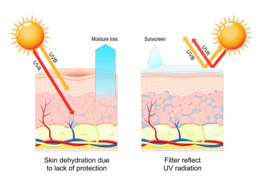 Cilt koruması. Güneş kremi, ultraviyole radyasyon ve SPF. Deri sağlığı. Erken yaşlanma ve güneş yanığı. Ultraviyole ışınları emiyor ve yansıtıyor. Derinin katmanlarında ultraviyole ışınlar var. Korunma eksikliği ve nem kaybından kaynaklanan susuzluk. Vektör çizimi. Tıbbi