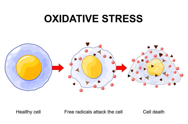 Окислительный стресс от здоровых клеток до гибели клеток. Апоптоз или некроз. Дисбаланс между производством свободных радикалов и антиоксидантов. Векторная иллюстрация. Медицинский плакат. Схематическая диаграмма