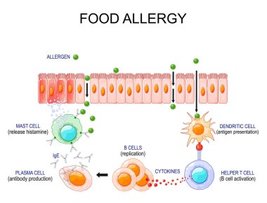 Gıda alerjisi. Alerjik reaksiyon ve bağışıklık tepkisi süreci. Vektör çizimi. Tıbbi poster. Şematik diyagram