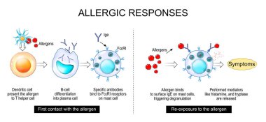 Alerji. Alerjenle ilk temas ve alerjene yeniden maruz kalma. Direk hücre yapısı. Histamin rolü, alerji, alerjik tepkilerde immünoglobülin IgE. Ayrıntılı vektör posteri